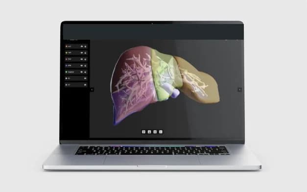 LiverAIz의 간과 혈관 3D 모델을 보여주는 수술 계획 소프트웨어 화면